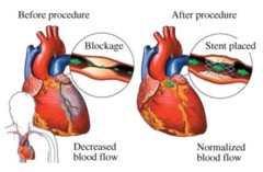 human heart